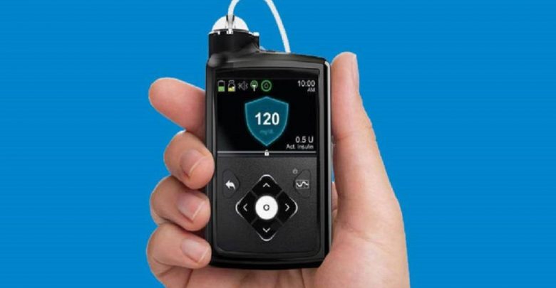 Minimed 670G permetterà a chi soffre di Diabete di tipo 1 di controllare meno la malattia