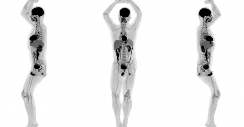 Produrre immagini 3D dell'intero corpo umano? Ora è possibile grazie a EXPLORER