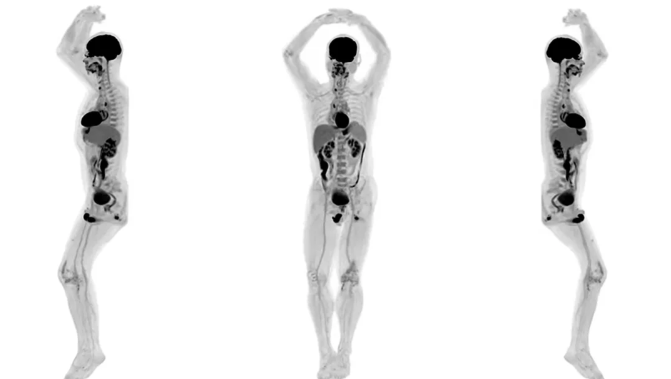 Produrre immagini 3D dell'intero corpo umano? Ora è possibile grazie a EXPLORER
