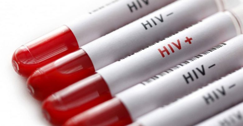Nuove prospettive nella cura dell'Aids: vaccino Tat riduce del 90% il serbatoio di virus latente