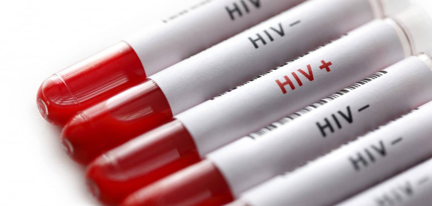 Nuove prospettive nella cura dell'Aids: vaccino Tat riduce del 90% il serbatoio di virus latente